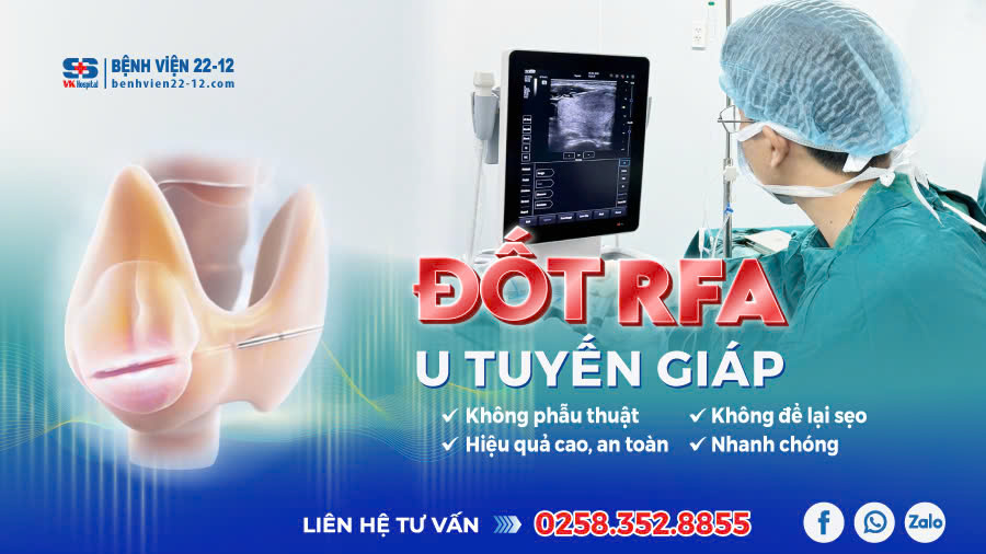 “Loại bỏ” U Tuyến Giáp Không Cần Phẫu Thuật - Giải Pháp An Toàn, Thẩm Mỹ Tại Bệnh Viện 22-12 “Loại bỏ” U Tuyến Giáp Không Cần Phẫu Thuật - Giải Pháp An Toàn, Thẩm Mỹ Tại Bệnh Viện 22-12