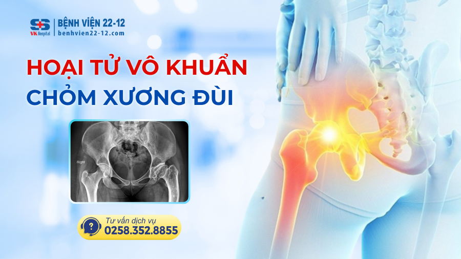 Bệnh viện 22-12 | Hoại tử vô khuẩn chỏm xương đùi Bệnh viện 22-12 | Hoại tử vô khuẩn chỏm xương đùi